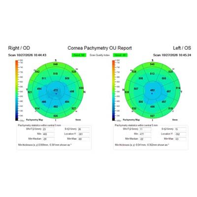 Exploración corneal
