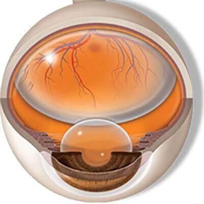 Retina, vítreo y mácula